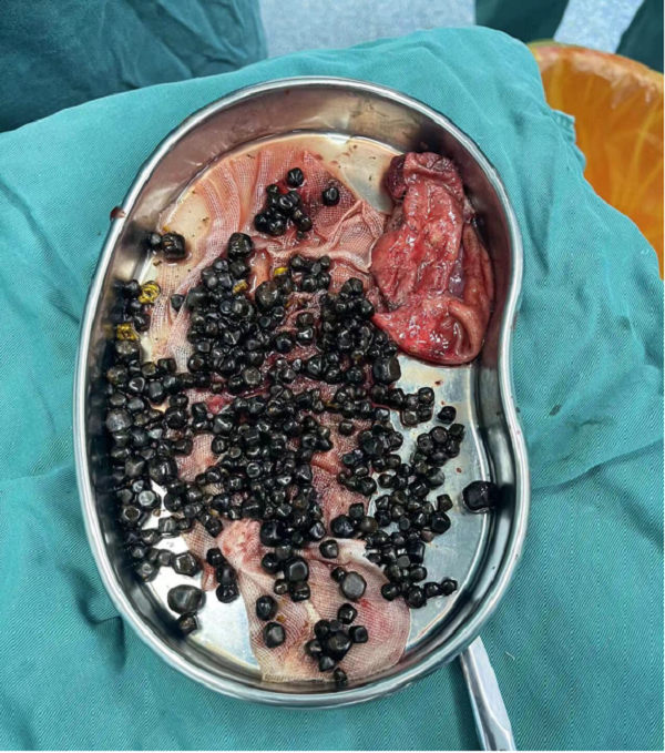 1657095195568624.png 2.png