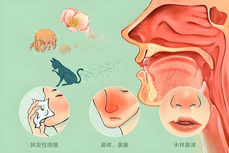 1729499843109625.jpeg 常见过敏源.jpg